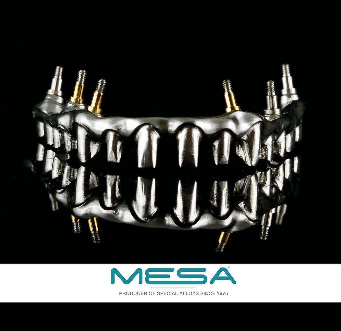 MESA IGEA İMPLANT | ESTETİK TASARIMLAR